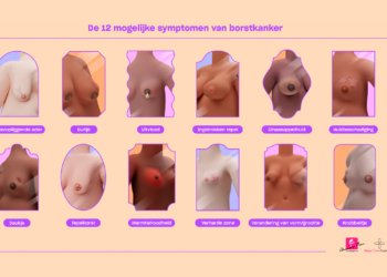 Gespecialiseerde borst(kanker)zorg in het Alexander Monro Ziekenhuis Vergoed door alle zorgverzekeraars en landelijk toegankelijk